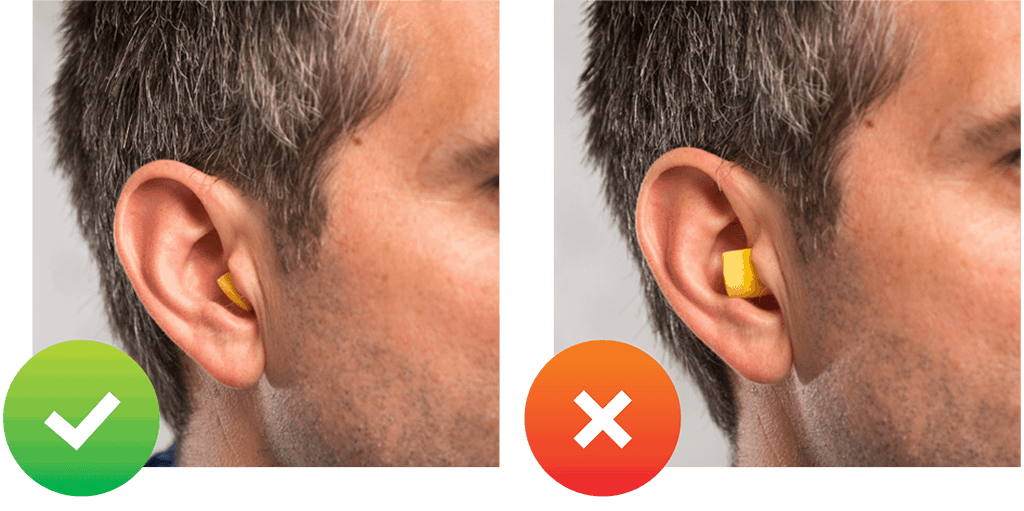 Gehörschutzstöpsel richtig tragen – Tipps vom Hersteller